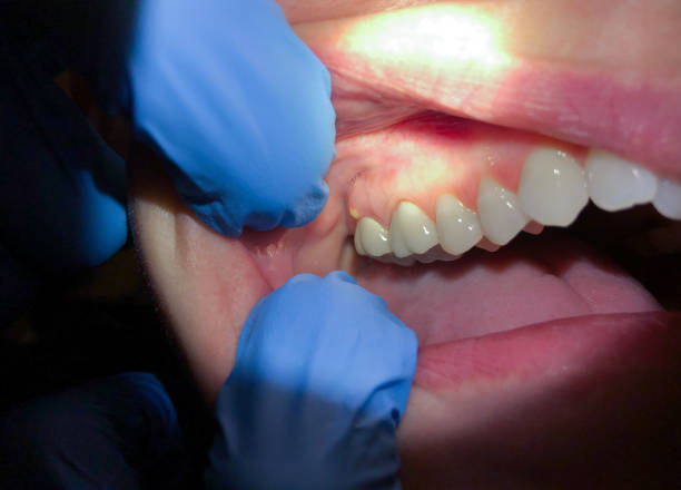 Best Root Canal Emergency Dentist  in Ramapo College Of New Jersey, NJ